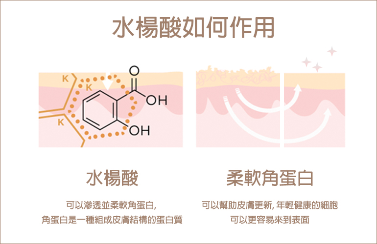 水楊酸的作用方式：柔軟角蛋白，幫助肌膚更新變得更健康，進而改善顆粒粉刺痘痘