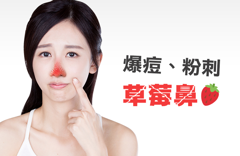 黑頭粉刺 草莓鼻