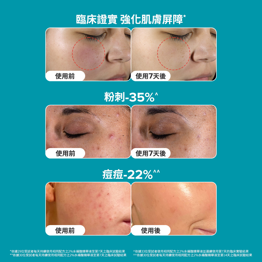 臨床證實 強化肌膚屏障